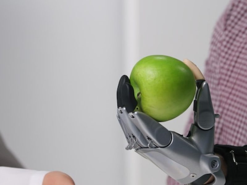 close-up-patient-hold-apple-bionic-arm-while-visiting-doctor-modern-clinic_867394-292